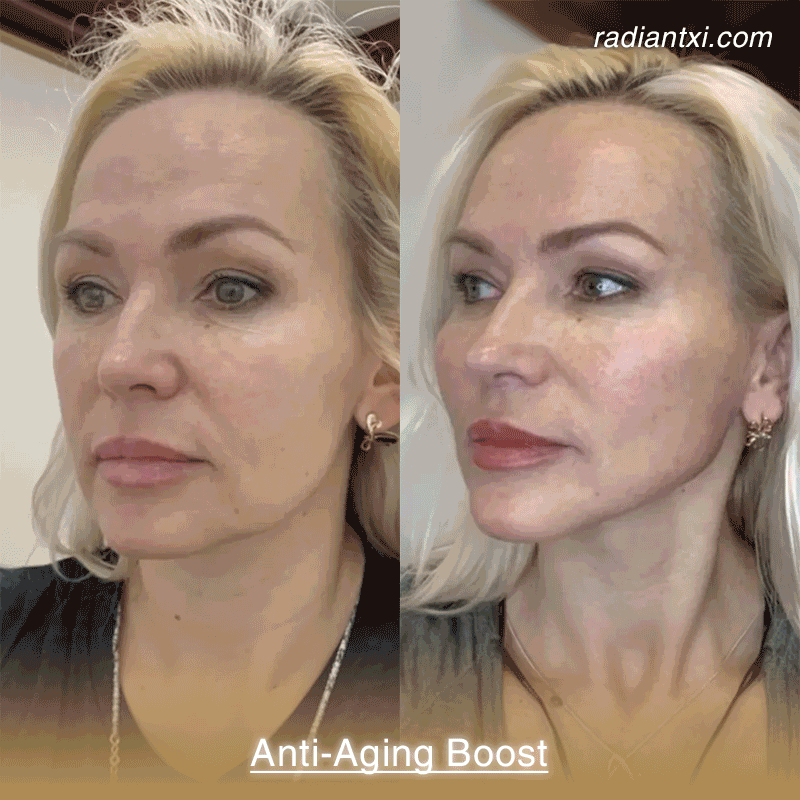 RadiantXI - LED Facial & Neck Sculptor