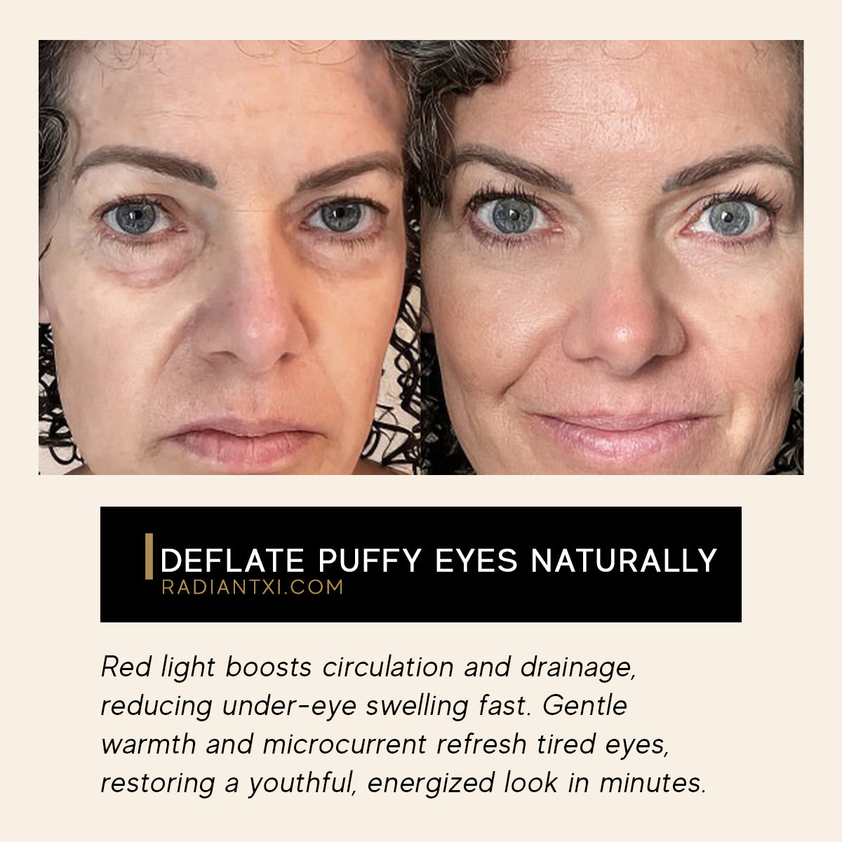 Under-Eye Light Therapy Massager