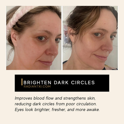 Under-Eye Light Therapy Massager