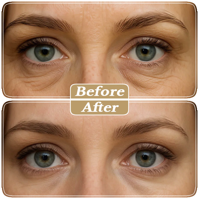 Under-Eye Gold Collagen Patches (12 Pairs)